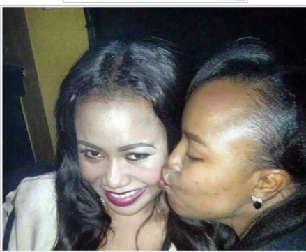 Vera Sidika immediately after she underwent skin lightening procedure in UK