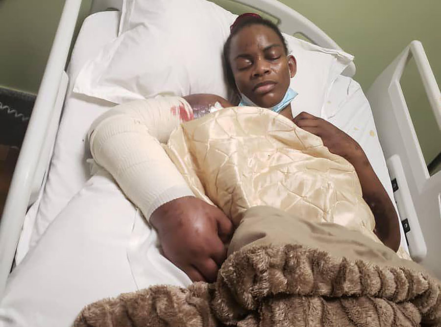 Marry Mubaiwa in hospital with her swollen arm before it was amputated. 